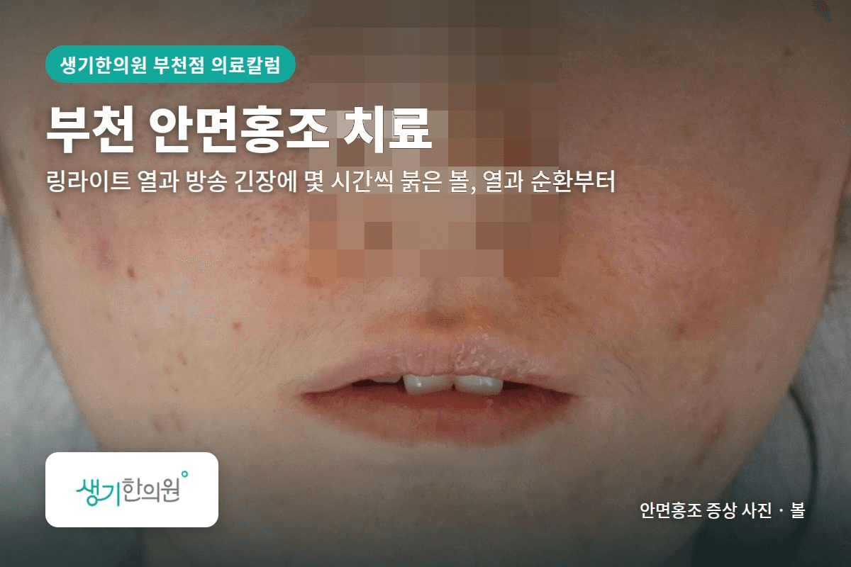 볼 안면홍조 증상 사진과 문구 「부천 안면홍조 치료, 링라이트 열과 방송 긴장에 몇 시간씩 붉은 볼, 열과 순환부터 · 생기한의원 부천점」