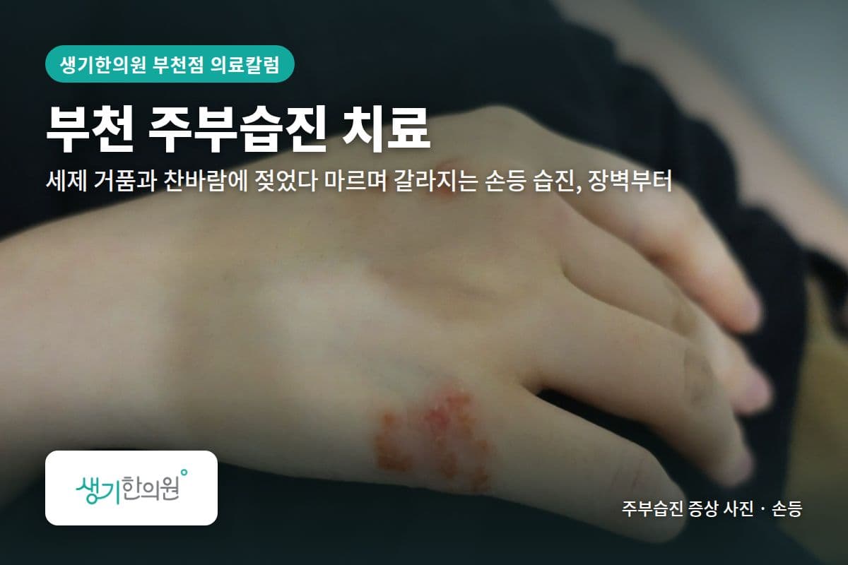 손등 주부습진 증상 사진과 문구 「부천 주부습진 치료, 세제 거품과 찬바람에 젖었다 마르며 갈라지는 손등 습진, 장벽부터 · 생기한의원 부천점」