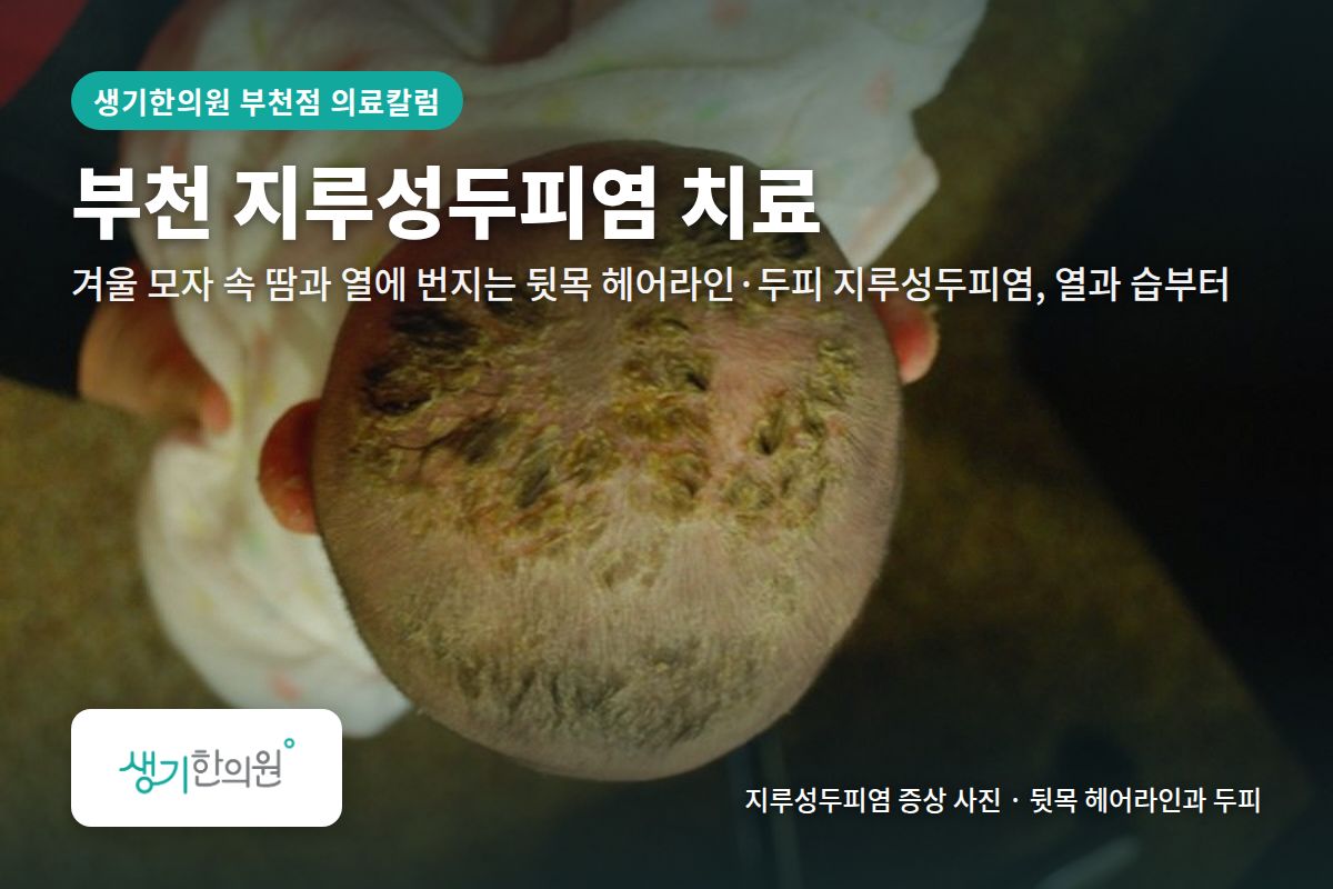 뒷목 헤어라인과 두피 지루성두피염 증상 사진과 문구 「부천 지루성두피염 치료, 겨울 모자 속 땀과 열에 번지는 뒷목 헤어라인·두피 지루성두피염, 열과 습부터 · 생기한의원 부천점」